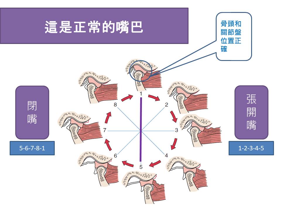 圖片說明：正常顳顎關節張嘴和閉嘴的結構圖