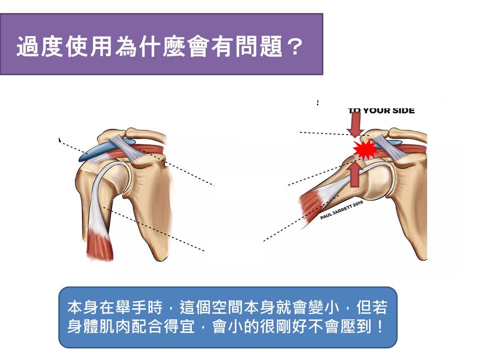 過度使用為什麼會有問題