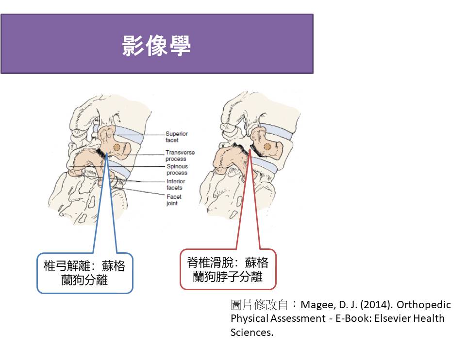 圖片說明：椎弓解離與滑脫影像學蘇格蘭小狗頸部變化