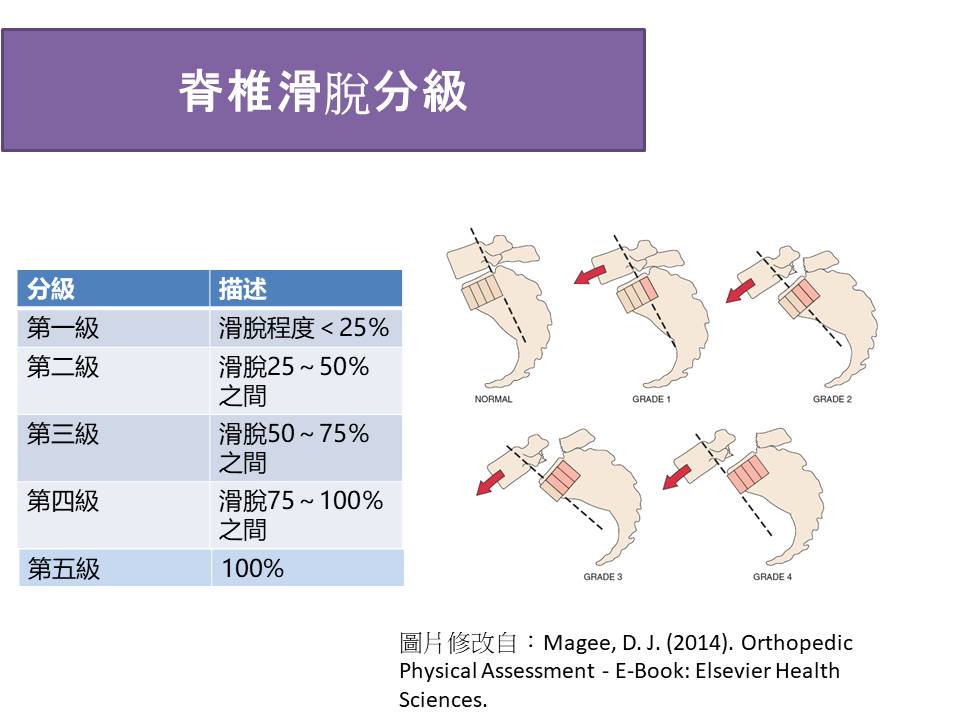 脊椎滑脫分級圖片以及說明