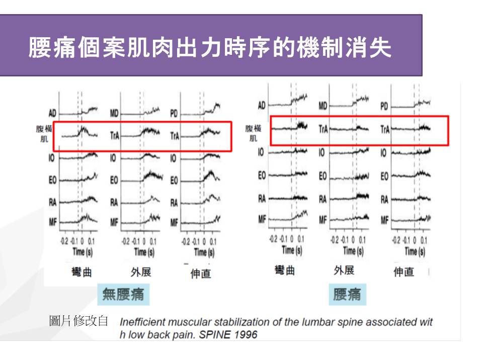 腰痛的人，內部核心肌群優先出力的機制消失