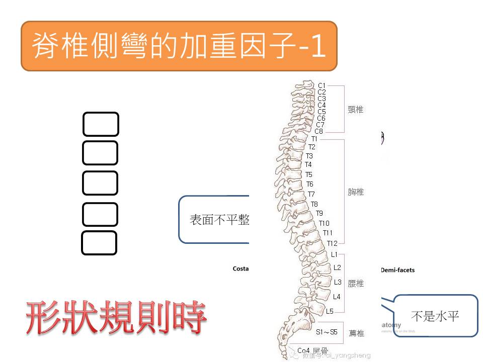 脊椎側彎2