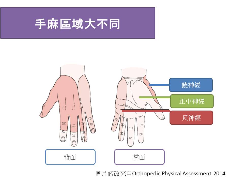 神經壓迫導致的手麻