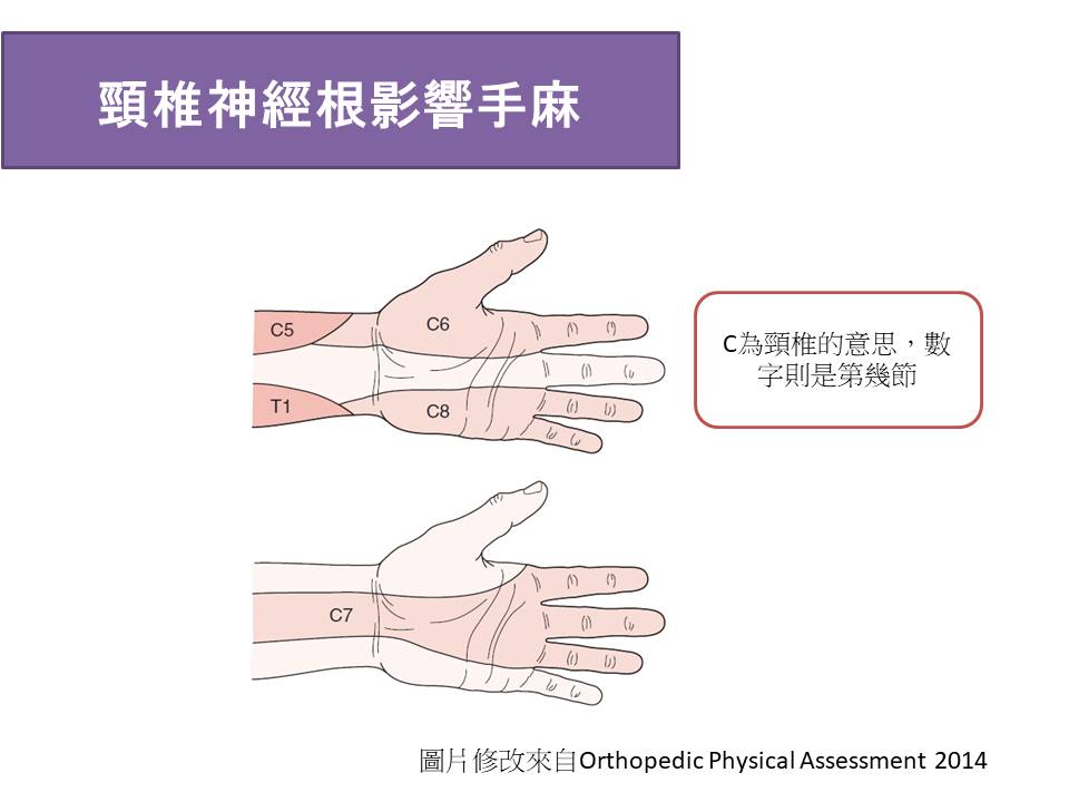 頸椎壓迫所導致的手麻