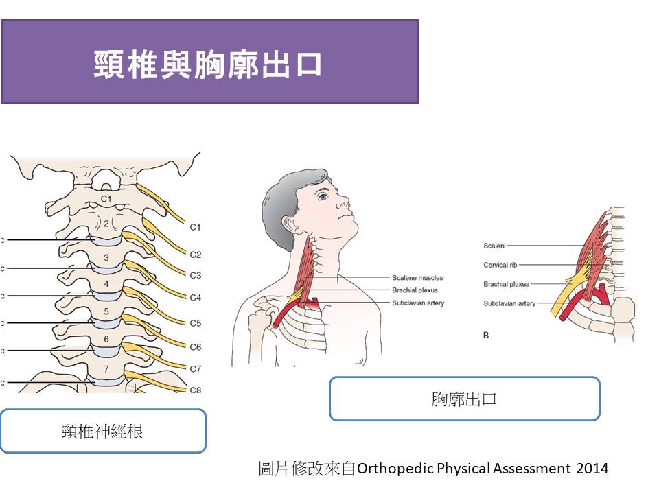 胸廓出口症候群與頸椎神經根壓迫